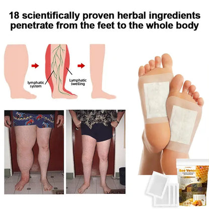 Bee Venom Lymphatic Drainage & Slimming Foot Patches 🌿👣